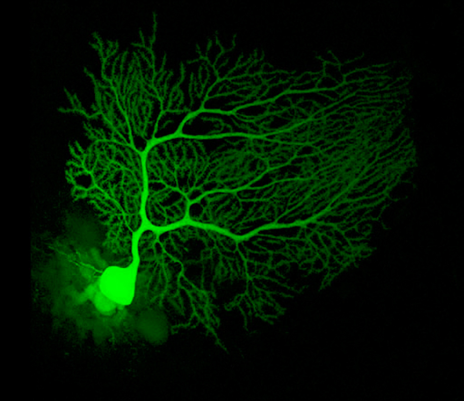 Neurons, shown above, are cells in the brain that transmit chemical signals. (credit: Courtesy of Wikimedia Commons)